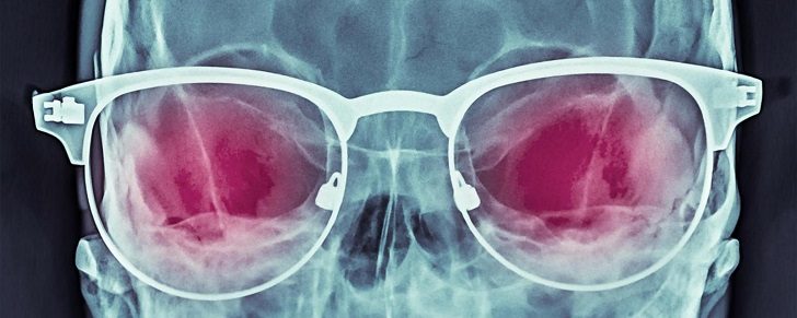 Skull with glasses, coloured X-ray.
