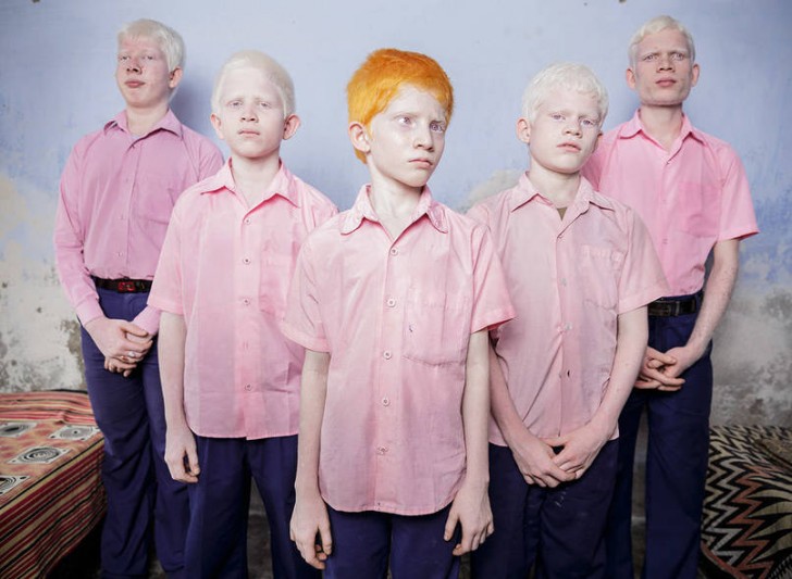 Ślepi albinosi ze szkoły w Indiach