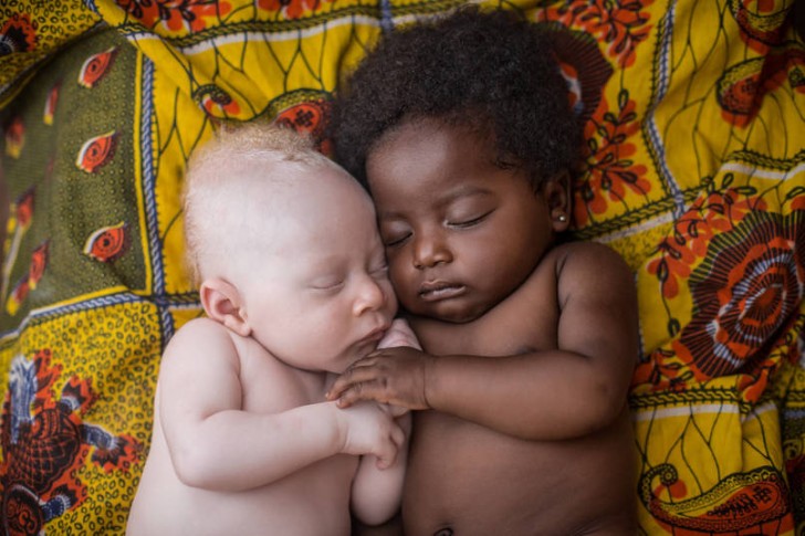 3-tygodniowe niemowle albinos śpi obok swojego kuzyna w Kinszasa, Kongo