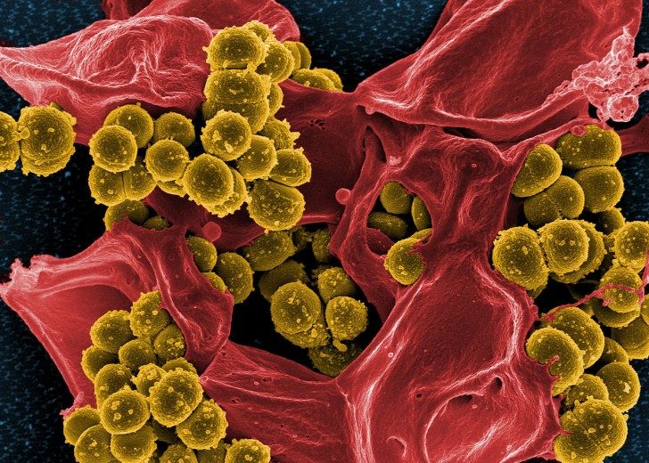 1280px-Scanning_electron_micrograph_of_Methicillin-resistant_Staphylococcus_aureus_(MRSA)_and_a_dead_Human_neutrophil_-_NIAID