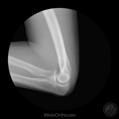 cool-anatomical-x-ray-gifs-that-show-how-joints-work-46334