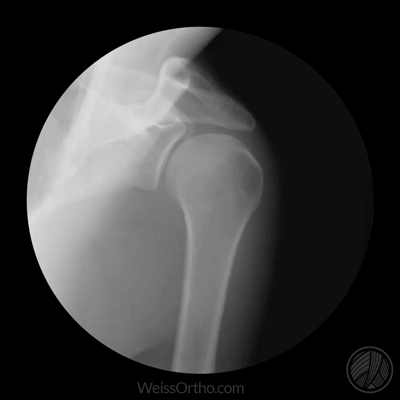 cool-anatomical-x-ray-gifs-that-show-how-joints-work-84530