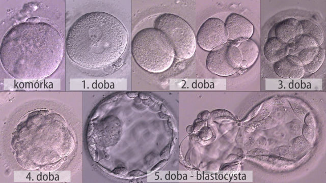 blastocysta