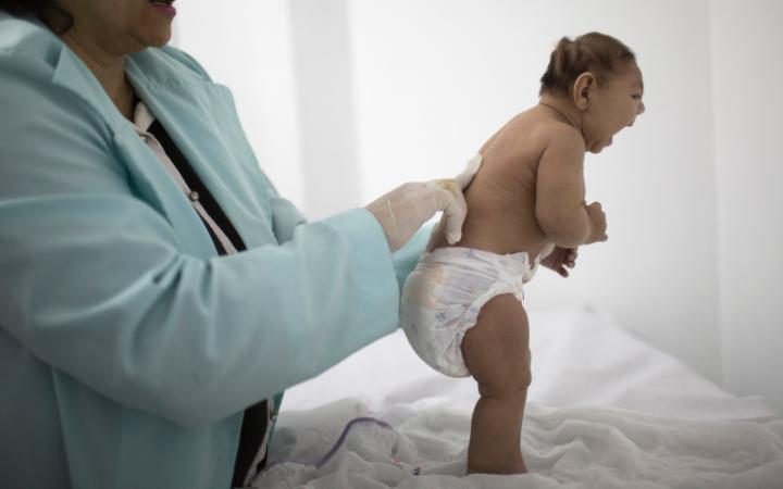 A dziecko, rodzi się z małogłowie, jest badane w Campina Grande, Brazylia kredytowe: FELIPE DANA / AP