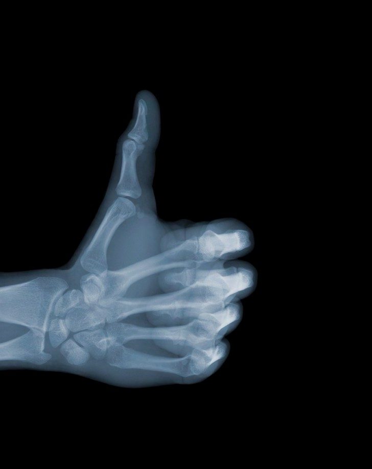 X-Ray-Photography-by-Nick-Veasey-Yellowtrace-20