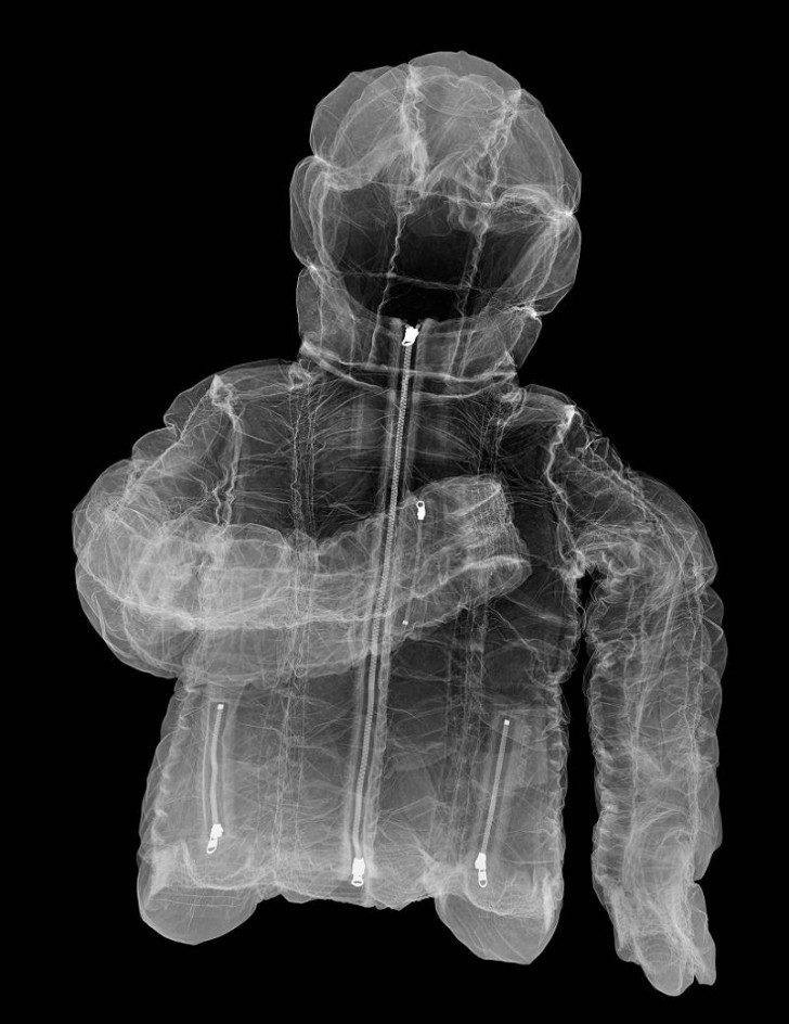 x-ray-of-jacket
